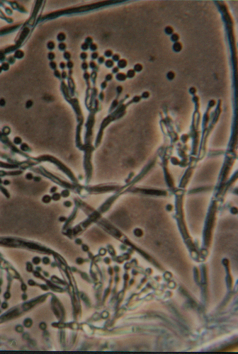 PENICILLIUM